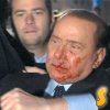 Министър-председателят на Италия Силвио Берлускони е заявил, че след нападението срещу него през средата на декември миналата година са му останали 35 зъба. \